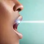 LASER-ZAHNAUFHELLUNG